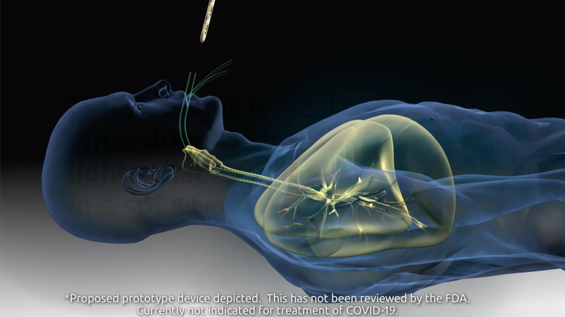 UV light treatment