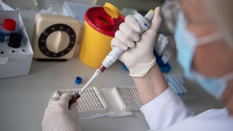COVID-19 bloodwork