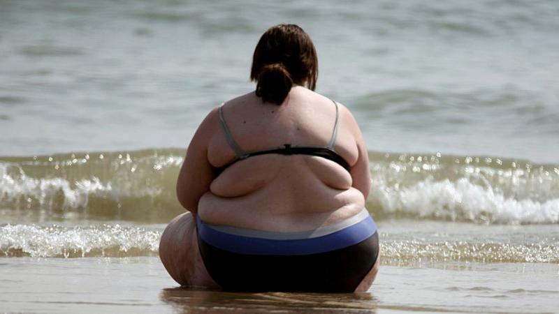 Obesity