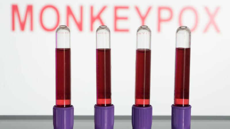 monkeypox