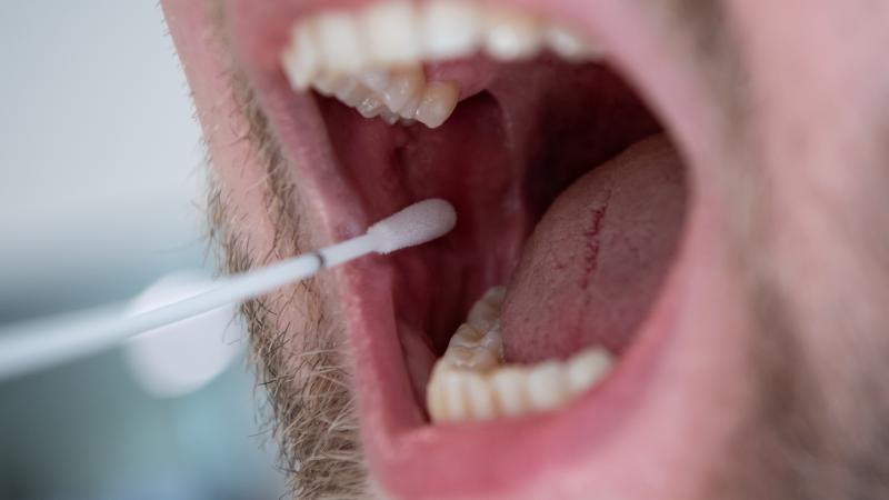 Man swabs for DNA test, Munich, Aug. 26, 2019